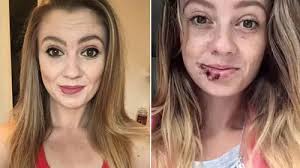 Devil dog' tore off elderly woman's face as its owners stood back and did  nothing