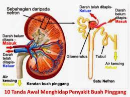 Penderita sakit pinggang bisa mengalami rasa sakit yang hilang timbul maupun terus menerus, pada. Tanda Tanda Punca Penyakit Buah Pinggang