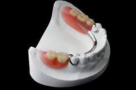 Partial dentures often have some form of clasp that attaches to your natural teeth and can easily be taken out of your mouth for cleaning or storing while you sleep. Partial Dentures Arc Dental