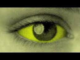 These mosquitoes thrive in and near human habitations where they breed in even the cleanest water. Fever 1793 Sutori