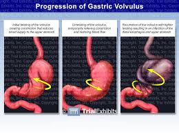 Image result for Volvulus