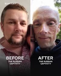 This is what three years in Russian captivity looks like… Another proof  that this isn't just captivity — it's a concentration camp. Making it out  unharmed is impossible.