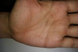 You can also find the answer related to the freckle on palm of hand here. What Does Your Mole Say About Your Personality