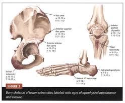 Image result for Hip Apophysitis