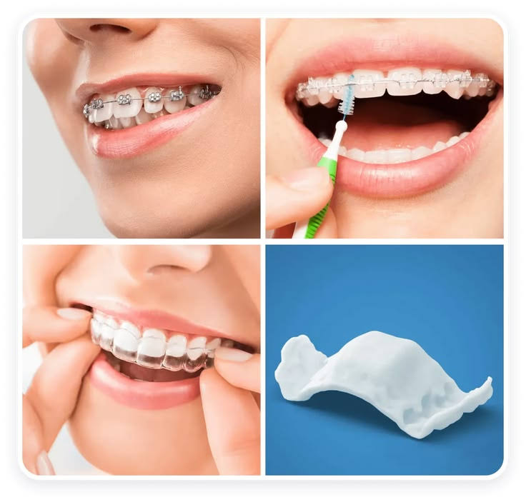 Orthodontist in Sus, Pune – Braces & Aligners product image