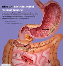 Having problems swallowing (dysphagia) feeling or being sick. What Is Gastrointestinal Stromal Tumors How Is It Treated