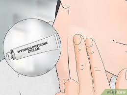 These steroid creams have been shown to reduce irritation, inflammation, and itching. 3 Ways To Stop Itching After Shaving Wikihow