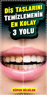 Dis Taslarini Temizlemenin En Kolay 3 Yolu Dogal Dis Beyazlatma Dis Dogal Cilt Bakimi