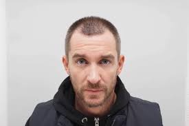 Emmerdale's Anthony Quinlan opens up about his 'life changing' hair  transplant surgery