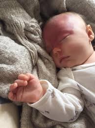 Lily is our hero! Let's help her achieve her full potential!