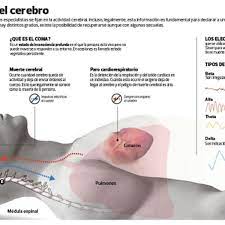 Si te gusta la literatura,las historias y textos que pondran tus neuronas en marcha pues siguenos y. Hay Que Distinguir Entre El Estado De Coma Y La Muerte Cerebral Tecnologia El Comercio Peru