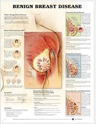 Benign Breast Disease Chart 9781587796746 Medicine