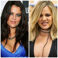 We may earn commission on some of the items you choose to buy. Plastic Surgery Gone Wrong Celebs Who Regret Getting Work Done
