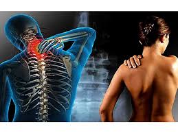 La nevralgia del nervo sciatico spesso passa da sola. Dolori Cervicali Come Curarli Osteopata A Milano