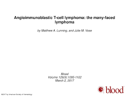 Dirk m elston, md more. Angioimmunoblastic T Cell Lymphoma The Many Faced Lymphoma Ppt Download