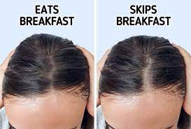 Women and men experience hair loss for a variety of reasons as they age, such as hereditary traits, endocrine disorders, thyroid disorders, reduced hormonal support, and nutritional deficiencies. 10 Daily Habits That Are Causing Your Hair To Thin