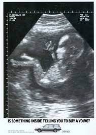 2d ultrasound with a look at your baby in 3d/4d. How Did The Fetal Ultrasound Become Such An Iconic Image Sifk