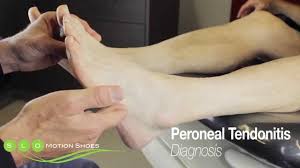 The tendons pictured here are the tendons that bend the toes upward. Peroneal Tendonitis Causes Diagnosis And Treatment Youtube