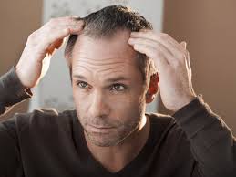 Let's take a look at the nine most common factors that cause men's hair loss. The Only 4 Things That Can Actually Prevent Hair Loss The Independent The Independent
