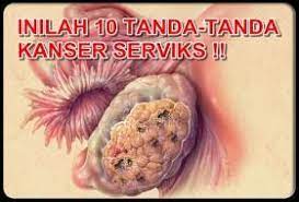 Kanser ovari atau kanser rahim sering digelar pembunuh senyap. Produk Kesihatan Kajian Saintifik Bydrazlan Wanita Perlu Baca Inilah 10 Tanda Tanda Kanser Serviks Yang Ramai Tak Tahu Mohon Kongsikan Kanser Pangkal Rahim Atau Serviks Adalah Sejenis Penyakit Di Mana Terdapatnya Sel Sel