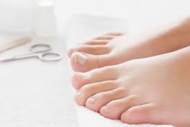 Salam, baru nie buat menu ketam masak pedas, sesekali makan ketam best jugak, tak boleh makan selalu sebab rumit tapi sedap!, kena berketuk tung tang time nak makan hehe, tapi kali ni ketuk dan pecahkan sesiap sepit ketam tu, senang sikit nak makan sebab ketam yang dibeli ni saiz besar so dah tentu kulit kemain tebal lagi. Waspadai Perubahan Warna Kuku Kaki Tandakan Ada Penyakit Halaman All Kompas Com