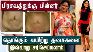 How To Reduce Weight And Belly Fat After Delivery In Tamil Health Tips In Tamil
