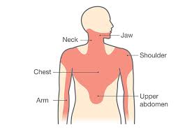 Image result for Chest Pain Observation Unit