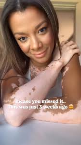 What I take: I Highly recommend Vitamin D3, Vitamin C, Multivitamin,  Magnesium, hair skin & nails essentials, platinum turmeric as well as  Smoothie greens 🥬 @jennyweaverworships