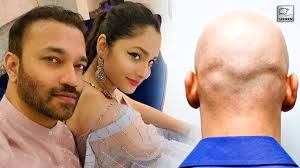 Is Ankita Lokhande's Husband Vicky Jain Bald? Big Blow- Big Boss