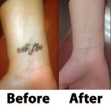 Hide Ink Tattoo Cover Waterproof Tattoo Concealer Tattoo Cover Up For Work And Special Occasions Cover Tattoo Waterproof Tattoo Cover Up Tattoo Cover Up