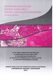 Maybe you would like to learn more about one of these? Pdf Diagnosis Molekuler Epstein Barr Virus Penatalaksanaan Karsinoma Nasofaring