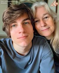 daughter stands up to future in-laws about her burn scar