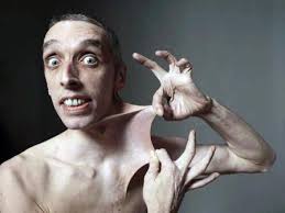 Garry Turner Umugabo Ufite Uruhu Rudasanzwe