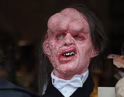 The Elephant Man's Untold Story