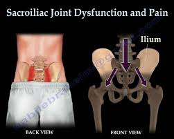 Within this group of back muscles you will find the latissimus dorsi, the these muscles collectively work to help movements of the vertebral column and to also control posture. Massage Therapy Is A Process Pain Relief Massage Wellness