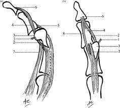 Image result for Lateral PIP Dislocation