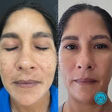 Zoë Bernard (Arscott), HOLISTIC SKIN EXPERT