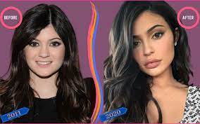 It seems that with whatever outfit she's wearing, her hair always matches. Kylie Jenner Before And After Plastic Surgery Celebscience
