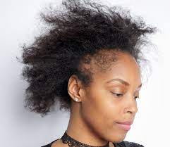 This different structure may contribute to cause some hair loss problems such as dry hair (poor in moisture). What Black Women Need To Know About Hair Loss The New York Times