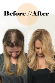 Pin On Extensions