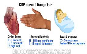 what is crp normal range rapid and hs c reactive protein