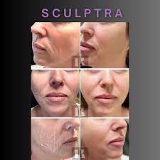 Kaitlynn Bray Aesthetics & Laser