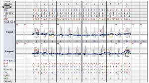 Periodontal Chart Demonstrates Classification Of Molar