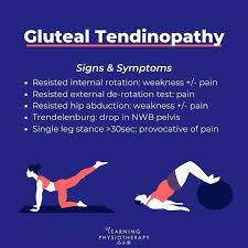 Image result for Resisted External Derotation Test