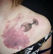 Mole Birthmark Tattoo Cover Up Funny Ideas That Are Either Genius Or Stupid 34 Pics Page 2 Of 4 Drollfeed Birthmark Tattoo Gorgeous Tattoos Cover Tattoo