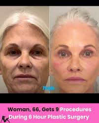 This just might be Abbe's year. The single mom of two never had plastic  surgery in her sights but she lucked into getting a full facial makeover  for free from popular surgeon