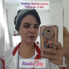 Peeling Químico para Olheiras 6 dia
