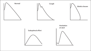 Acceptable And Unacceptable Flow Volume Loops Download