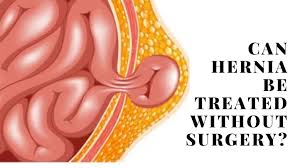 Image result for Hernia Reduction