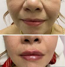 Dra Rubí Orendain Salcedo (@dra.rubi.orendain) · Instagram 照片和视频